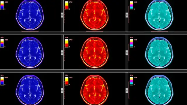 Cerveau Ce Que Les Neurosciences Nous Apprennent Sur Le Plaisir BBC