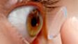 CONTACT LENS