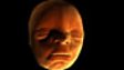 How do our faces develop in the womb?