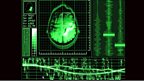 Coma Patient Scan