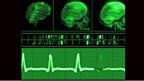 Vital Signs