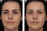 Facial Contrast