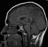 BRAIN Initiative