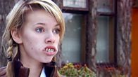 Brace Mouth