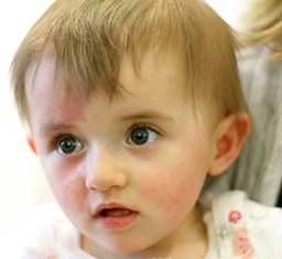 miraculous story of baby Angelina