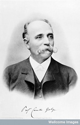Italian doctor Camillo Golgi 