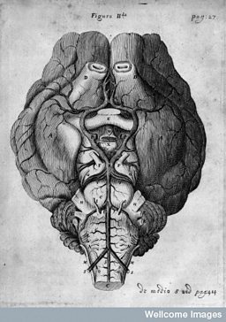 Circle of Willis