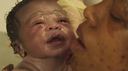 Water Birth