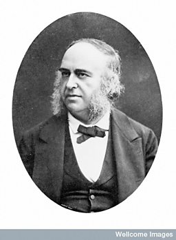Portrait of Pierre-Paul Broca