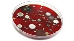 Bacteruim grown in a petri /cell culture dish