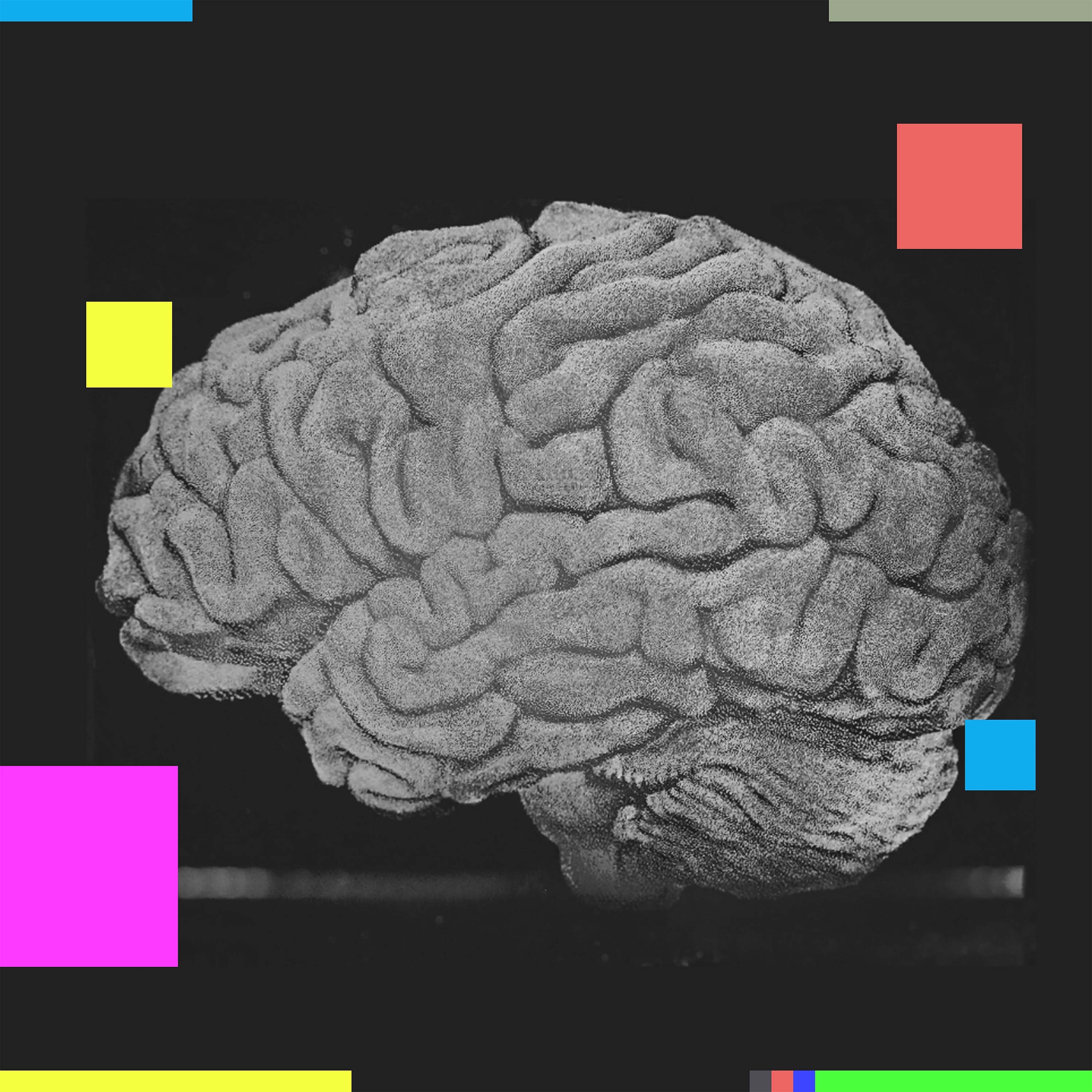 Is Havana Syndrome really real?