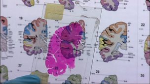 Image for Deaf with Dementia