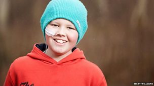 Image for Deryn Blackwell prepares for bone marrow transplant