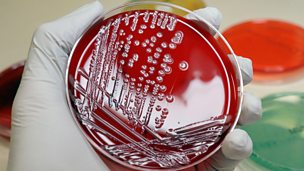 Image for Clarrie resigns over the E coli (Aug 2011)
