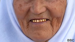 Image for Why gold makes good teeth