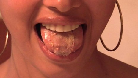 tongue mesh
