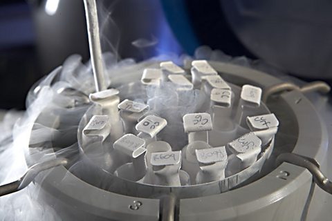 Yeast preserved in liquid nitrogen