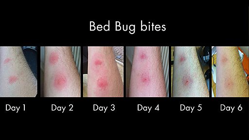 bed bugs bite and what we can do to stop them if anything when the bed ...