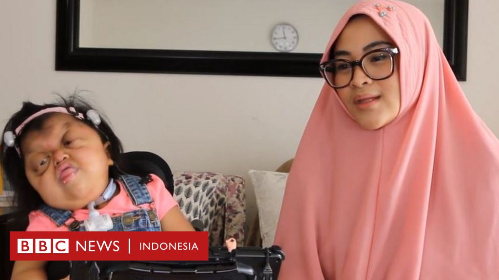 Sehari Bersama Illona Dan Bella Ibu Yang Membesarkan Putri Dengan