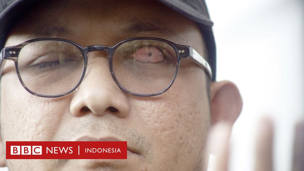 Novel Baswedan Fakta Fakta Dalam Kasus Hari Penantian Tanpa