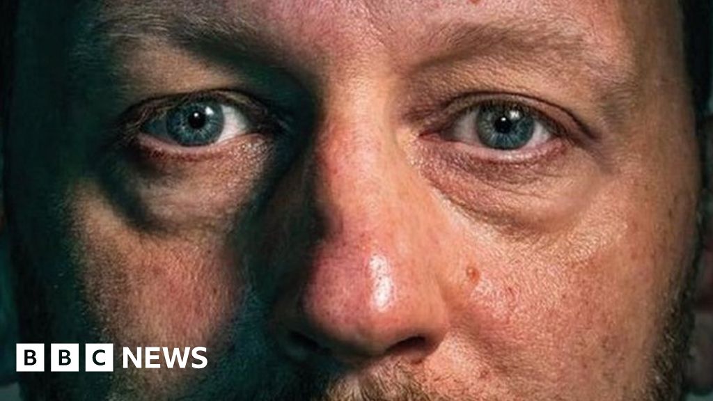 Stop Saying Junkie Plea To End Addiction Stigma Bbc News