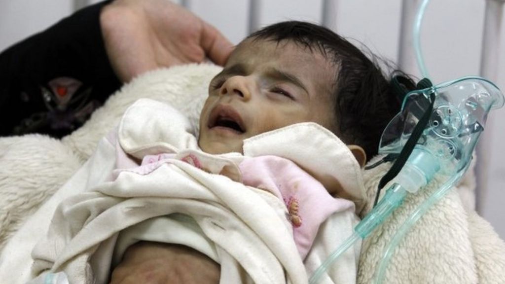الأمم المتحدة تحذر من مجاعة وشيكة في اليمن - BBC Arabic