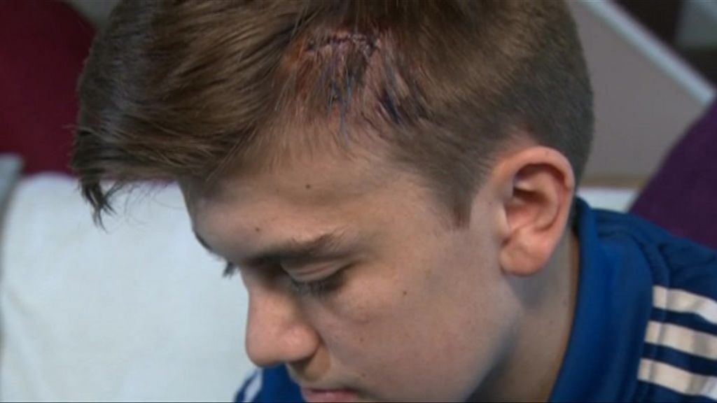 Boy injured in clown craze attack in Rotherham