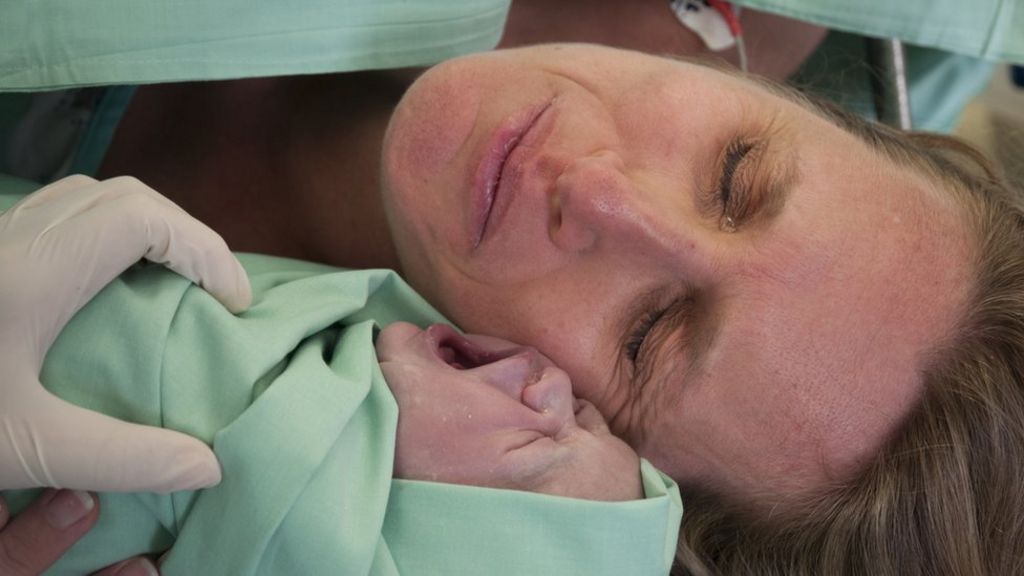 Caesarean births 'affecting human evolution'