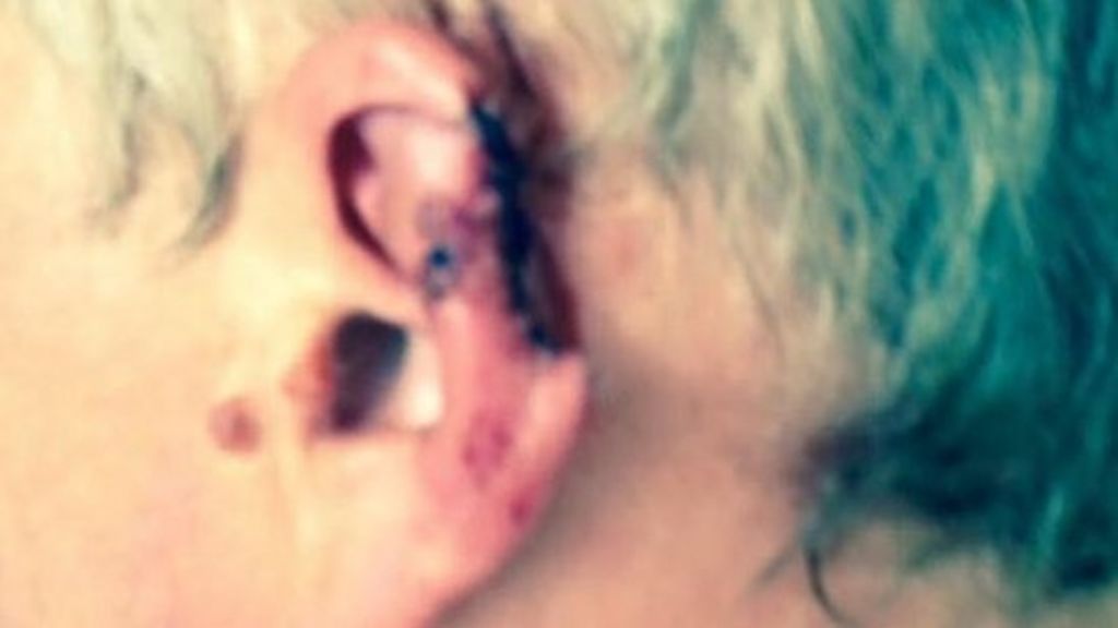 Man had ear bitten off at festival