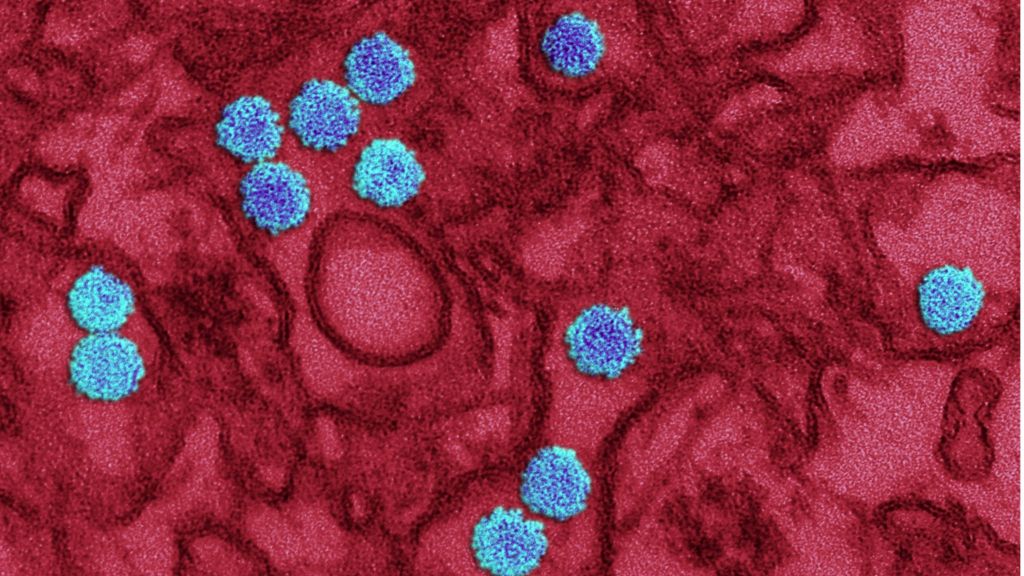 Zika: The key unanswered questions - BBC News