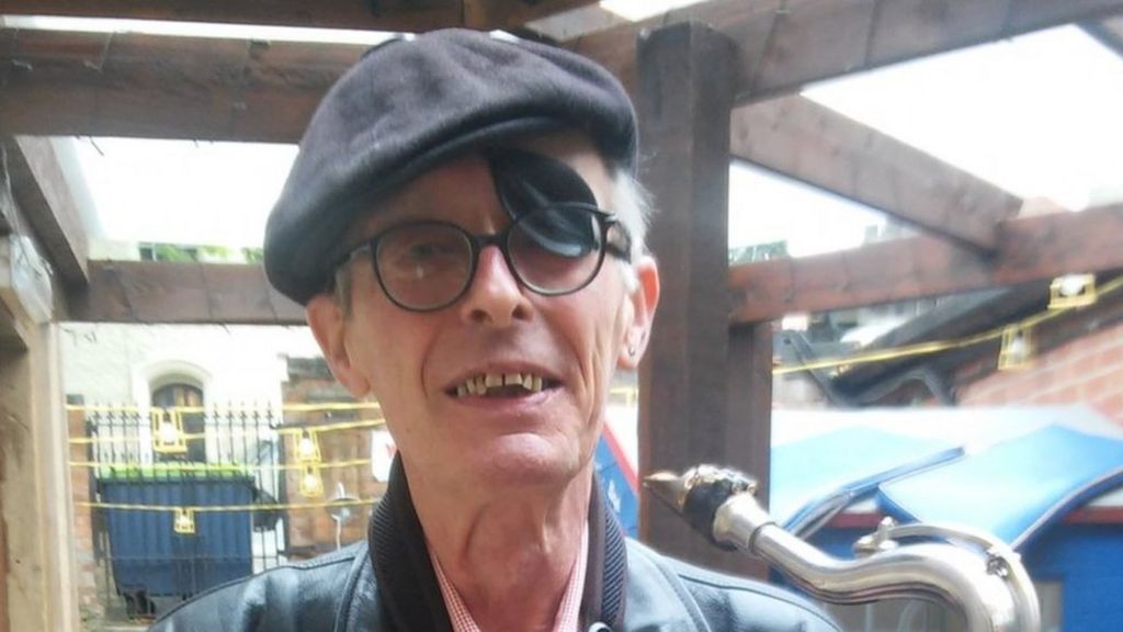 Nottingham musician 'overwhelmed' by teeth appeal - BBC News