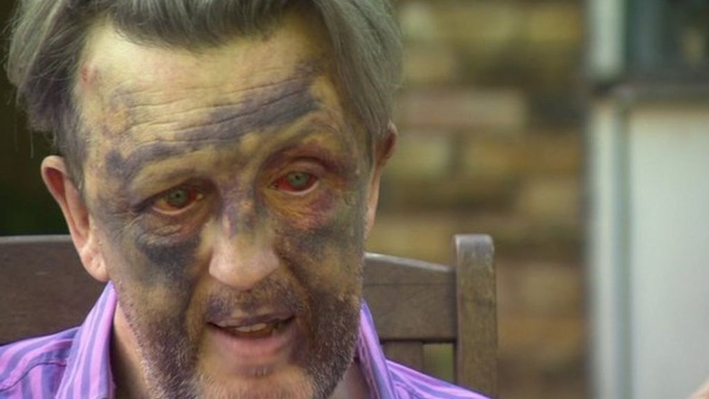 Crime victims should have legal right to contact offenders - MPs