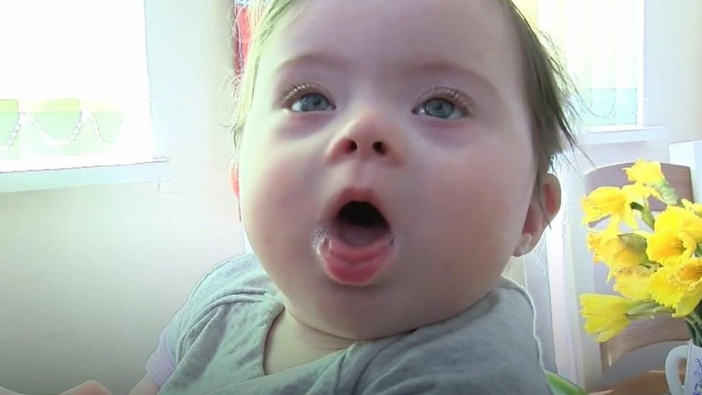 Downs Syndrome Mum Dont Feel Sorry For Us Bbc News 