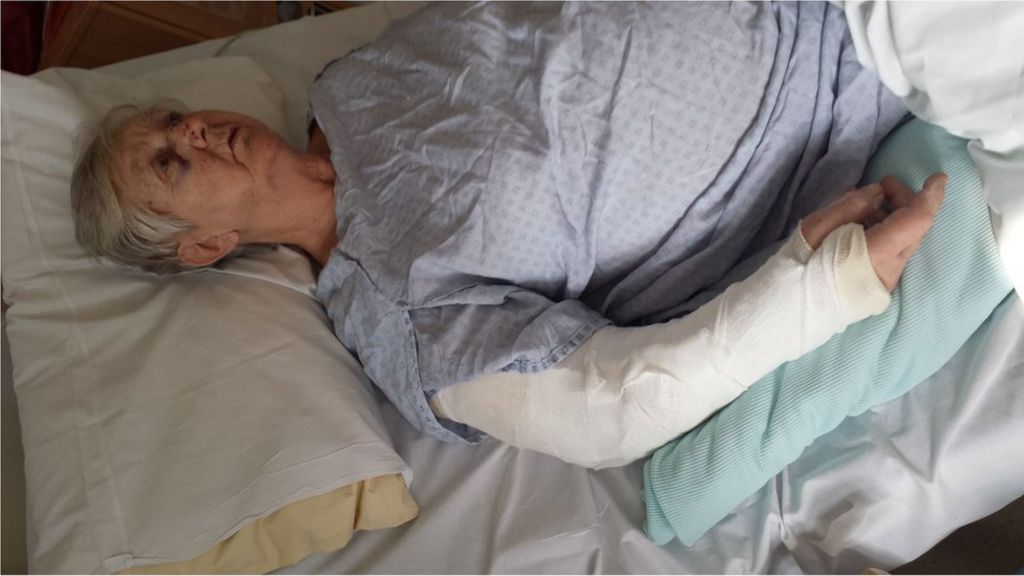 Woman, 79, has arm broken in Coventry bag snatch