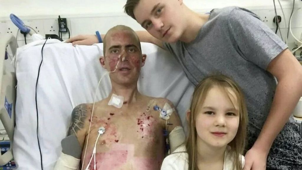 Nottingham man Mark Camamile's bionic arm campaign attracts £30k