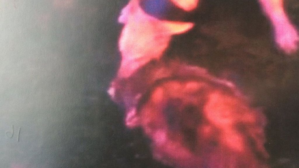 'Barbaric' badger killer jailed