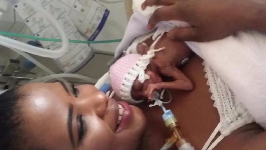 Oldham miracle 'bag of sugar' baby goes home with mum