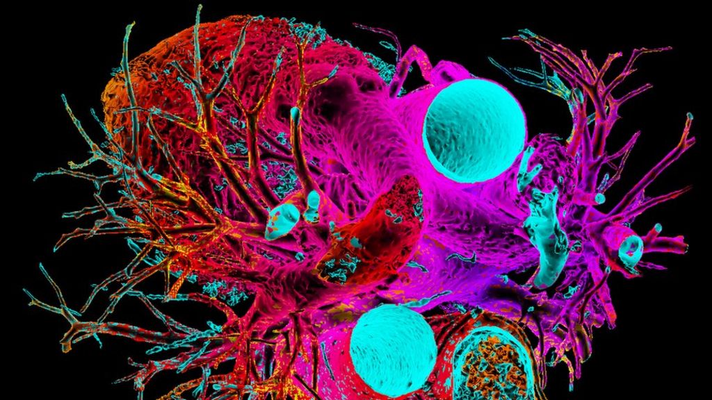 Pig heart kept beating in baboon