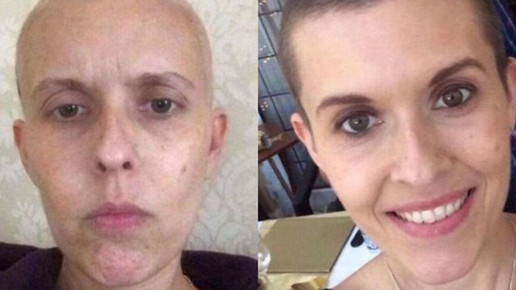 'Why I've raised £135,000 for my cancer treatment'