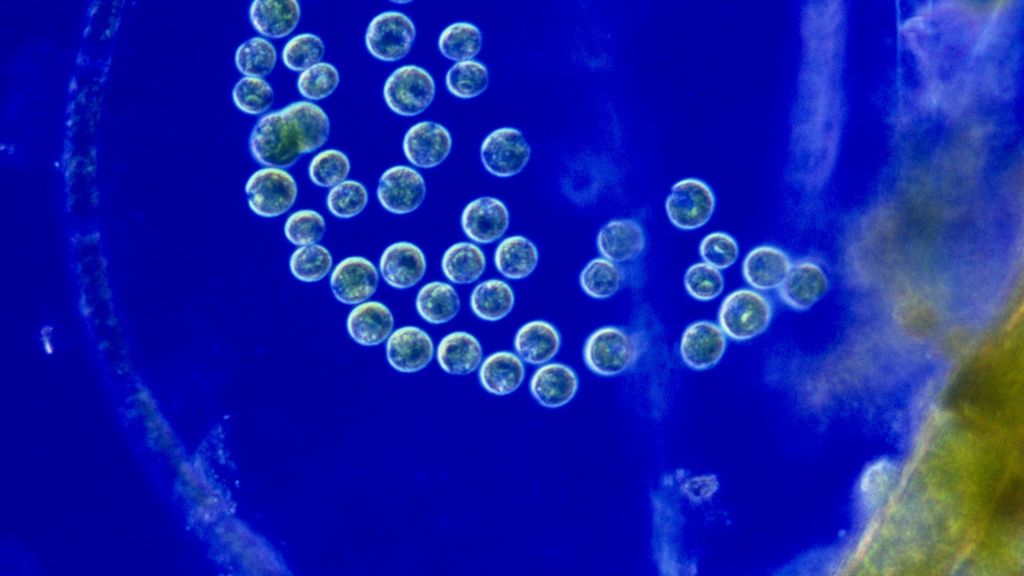 Bacteria 'see' like tiny eyeballs