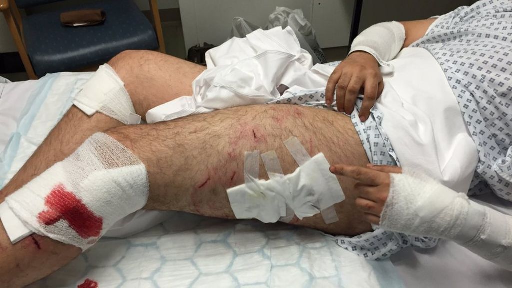 Chorley police dog attack victim 'called thief by officers'