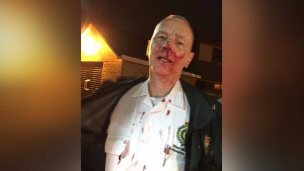 Head-butted ambulance worker's fears for repeat attack