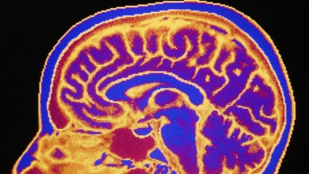 3D printing aids life-saving surgery