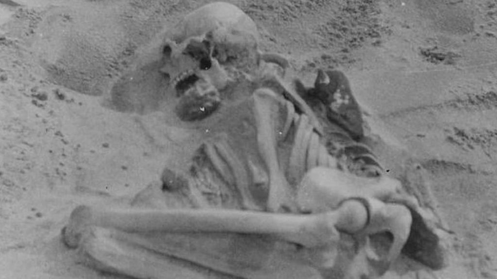 Oldest rickets case in Neolithic woman