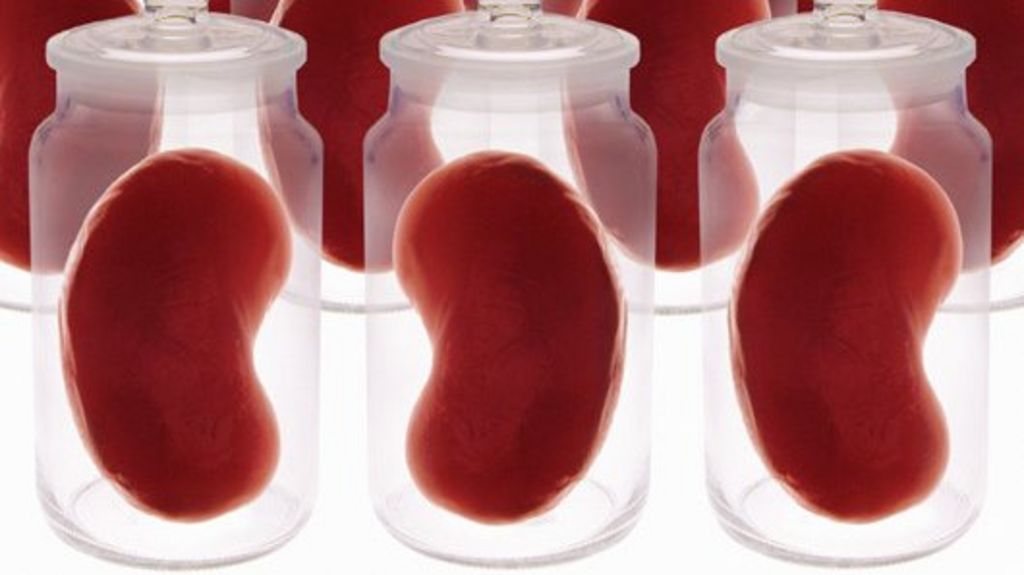 Pakistani police rescue 24 from organ trafficking gang - BBC News