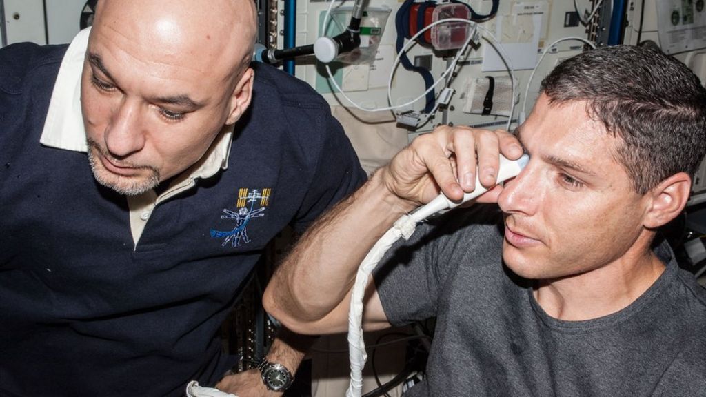 Astronaut eye problems blamed on spinal fluid