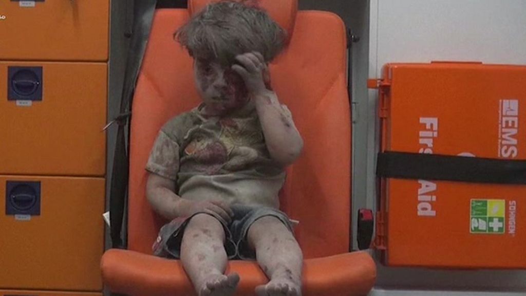 Injured Syrian boy Omran didn't cry, says doctor
