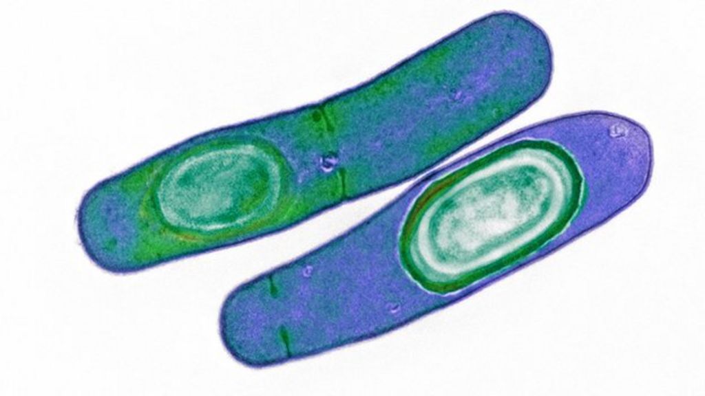 Super bug linked to five deaths