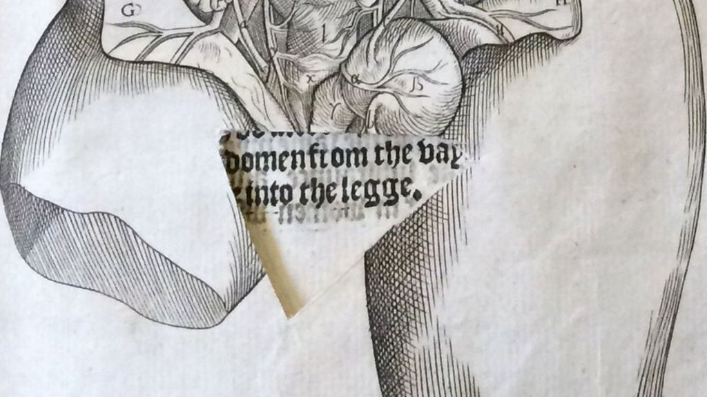 Book suggests taboos held back knowledge of female body