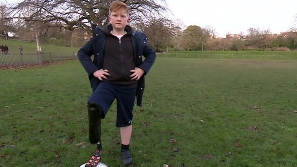 Running towards Paralympic dream with NHS blade